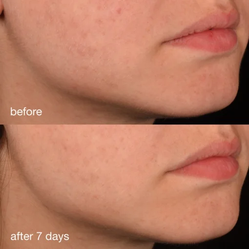 Антиоксидантная сыворотка с коллагеном Dermalogica Pro-Collagen Banking Serum, 30 мл